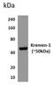 Kringle Containing Transmembrane Protein 1 antibody, NBP1-22498, Novus Biologicals, Western Blot image 