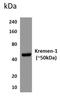 Kringle Containing Transmembrane Protein 1 antibody, NBP1-22498, Novus Biologicals, Western Blot image 