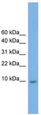 Keratin Associated Protein 23-1 antibody, TA338960, Origene, Western Blot image 