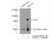 DEAD-Box Helicase 3 X-Linked antibody, 11115-1-AP, Proteintech Group, Immunoprecipitation image 
