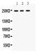 Receptor-type tyrosine-protein phosphatase F antibody, PB9786, Boster Biological Technology, Western Blot image 