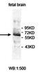 Zinc Finger Protein 280A antibody, orb78052, Biorbyt, Western Blot image 