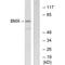 BMX Non-Receptor Tyrosine Kinase antibody, A02537, Boster Biological Technology, Western Blot image 