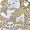 TERF2 Interacting Protein antibody, A7981, ABclonal Technology, Immunohistochemistry paraffin image 
