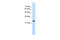 Nicotinamide N-Methyltransferase antibody, 29-728, ProSci, Enzyme Linked Immunosorbent Assay image 