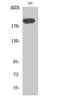 Mannose Receptor C Type 2 antibody, PA5-50956, Invitrogen Antibodies, Western Blot image 