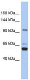 Transient Receptor Potential Cation Channel Subfamily M Member 8 antibody, TA338711, Origene, Western Blot image 