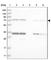 Lanosterol synthase antibody, HPA032062, Atlas Antibodies, Western Blot image 