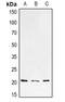 HRas Proto-Oncogene, GTPase antibody, LS-C668063, Lifespan Biosciences, Western Blot image 