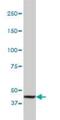 PTPRS antibody, H00005802-M01, Novus Biologicals, Western Blot image 