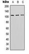 DNA Methyltransferase 3 Alpha antibody, LS-C354380, Lifespan Biosciences, Western Blot image 