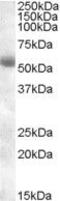 Transmembrane Serine Protease 2 antibody, PA5-18847, Invitrogen Antibodies, Western Blot image 