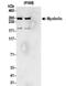 Myoferlin antibody, NBP2-32264, Novus Biologicals, Immunoprecipitation image 
