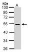 Serine/Threonine Kinase 25 antibody, NBP1-32670, Novus Biologicals, Western Blot image 