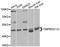 Transmembrane Serine Protease 11A antibody, A8605, ABclonal Technology, Western Blot image 