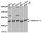 Transmembrane protease serine 11A antibody, A8605, ABclonal Technology, Western Blot image 