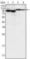 Bruton Tyrosine Kinase antibody, MA5-15337, Invitrogen Antibodies, Western Blot image 