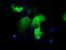 Immunoglobulin Binding Protein 1 antibody, MA5-25107, Invitrogen Antibodies, Immunocytochemistry image 