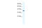 Potassium Two Pore Domain Channel Subfamily K Member 3 antibody, 28-238, ProSci, Western Blot image 