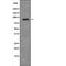 MDM2 Proto-Oncogene antibody, PA5-64761, Invitrogen Antibodies, Western Blot image 