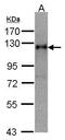 Timeless Circadian Regulator antibody, GTX104334, GeneTex, Western Blot image 