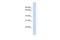 Tubulin Gamma 2 antibody, A13175, Boster Biological Technology, Western Blot image 