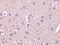 Collapsin Response Mediator Protein 1 antibody, 3623, ProSci, Immunohistochemistry paraffin image 