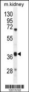 Dihydrouridine Synthase 4 Like antibody, 55-573, ProSci, Western Blot image 