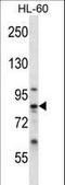 Calpain 6 antibody, LS-C168304, Lifespan Biosciences, Western Blot image 