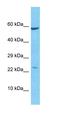 KRAB domain-containing protein ZNF321 antibody, orb325610, Biorbyt, Western Blot image 