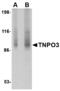 Transportin 3 antibody, LS-C53298, Lifespan Biosciences, Western Blot image 