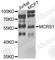 Microspherule Protein 1 antibody, A8061, ABclonal Technology, Western Blot image 
