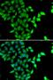 Signal Transducing Adaptor Molecule 2 antibody, orb247773, Biorbyt, Immunocytochemistry image 