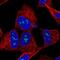 Tropomodulin 2 antibody, NBP1-87378, Novus Biologicals, Immunofluorescence image 