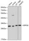 Ribonuclease P/MRP Subunit P30 antibody, 23-613, ProSci, Western Blot image 