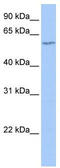 DNA Nucleotidylexotransferase antibody, TA340045, Origene, Western Blot image 