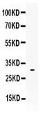 Tryptase Alpha/Beta 1 antibody, PA5-80177, Invitrogen Antibodies, Western Blot image 