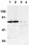 TNF Receptor Superfamily Member 21 antibody, GTX28417, GeneTex, Western Blot image 