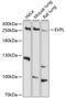 Envoplakin antibody, A09421, Boster Biological Technology, Western Blot image 