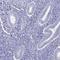 Acyl-CoA Synthetase Bubblegum Family Member 2 antibody, NBP2-33603, Novus Biologicals, Immunohistochemistry frozen image 