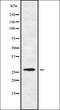 Complement Factor D antibody, orb338207, Biorbyt, Western Blot image 