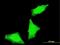 PPP1R2 Family Member B antibody, MA5-23117, Invitrogen Antibodies, Immunofluorescence image 