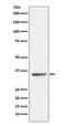 Sirtuin 5 antibody, M02395, Boster Biological Technology, Western Blot image 