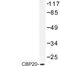 Nuclear cap-binding protein subunit 2 antibody, LS-C176776, Lifespan Biosciences, Western Blot image 