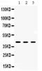 Alpha-Methylacyl-CoA Racemase antibody, LS-C662453, Lifespan Biosciences, Western Blot image 