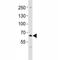 Proprotein Convertase Subtilisin/Kexin Type 9 antibody, F52952-0.4ML, NSJ Bioreagents, Western Blot image 