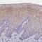 Multivesicular body subunit 12A antibody, HPA042231, Atlas Antibodies, Immunohistochemistry paraffin image 