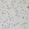 Crystallin Mu antibody, GTX64761, GeneTex, Immunohistochemistry paraffin image 