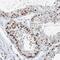 Small Ubiquitin Like Modifier 2 antibody, NBP2-46758, Novus Biologicals, Immunohistochemistry paraffin image 