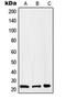 RAB2B, Member RAS Oncogene Family antibody, orb215331, Biorbyt, Western Blot image 